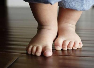 راه های تشخیص و درمان کج شدن پای نوزاد چیست؟