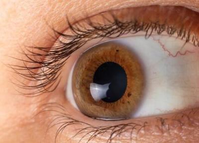 6 بیماری مهم که چشم ها در خصوص آنها هشدار می دهند