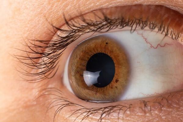 6 بیماری مهم که چشم ها در خصوص آنها هشدار می دهند